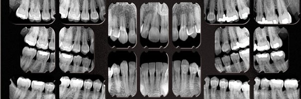 Bilan Long cone Avignon 